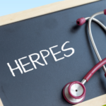 What Does Herpes Look Like